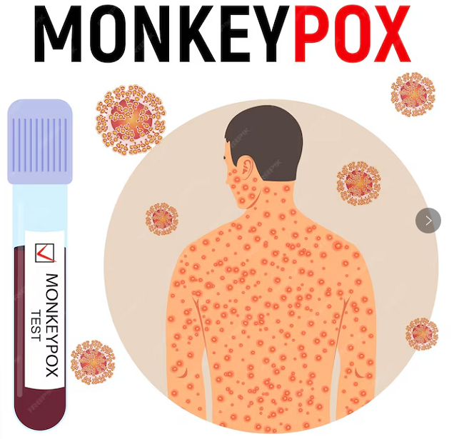 Monkeypox Virus Detection
