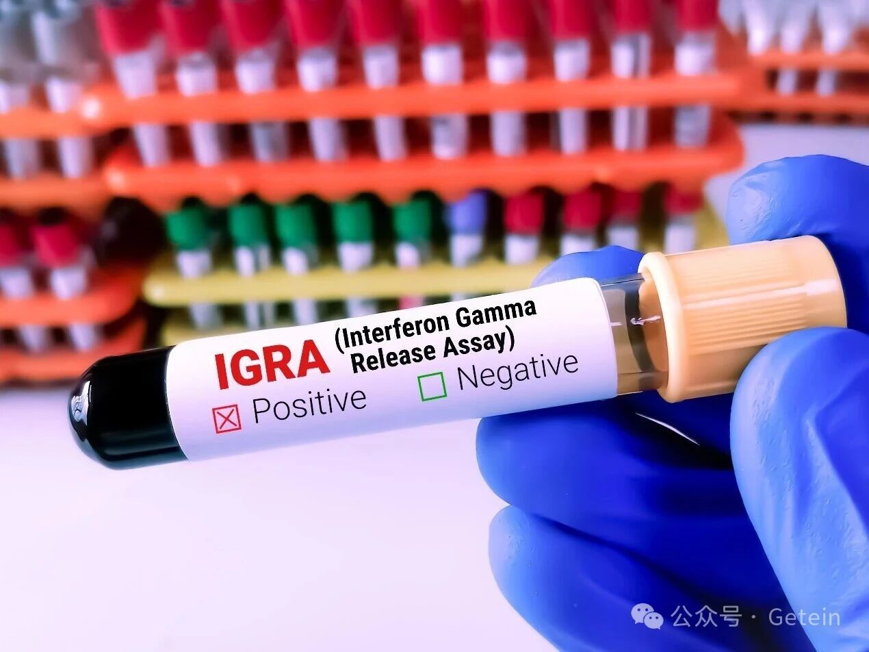 Комплексное и точное решение для тестирования TB-IGRA